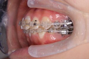 スペースクローズ