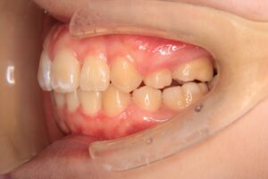 スペースクローズ